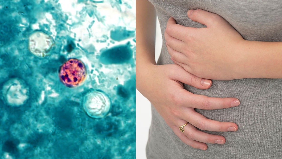 'Explosive' diarrhea parasite hits Illinois as CDC searches for source