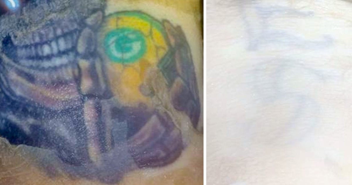 Severed arm with Green Bay Packers tattoo found in Illinois lake belonged to Plainfield man, police say Severed arm with Green Bay Packers tattoo found in Illinois lake belonged to Plainfield man, police say