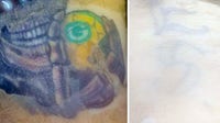 Severed arm with Green Bay Packers tattoo found in Illinois lake belonged to Plainfield man, police say