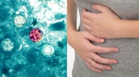 'Explosive' diarrhea parasite hits Illinois as CDC searches for source