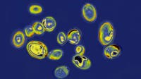 Drug-resistant germs a growing threat to Americans