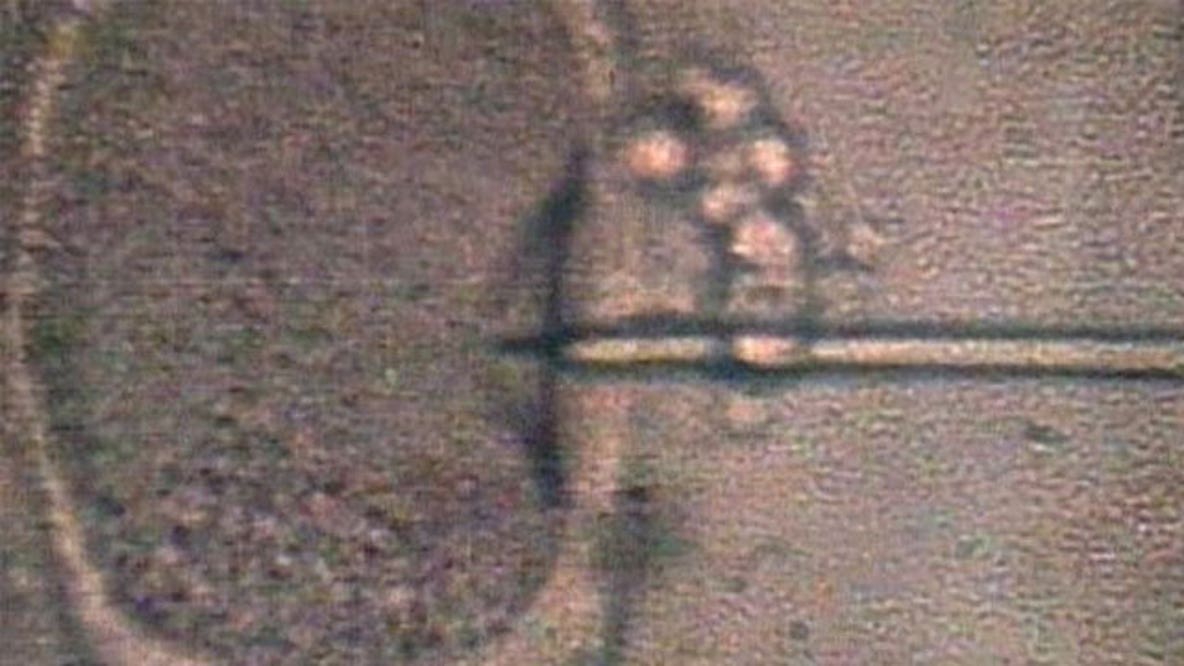 IVF mix-up lawsuit moves forward after woman gives birth, learns baby is not from her embryo