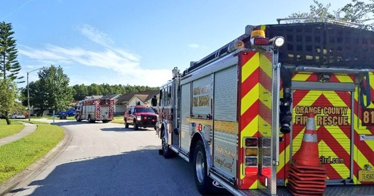 Woman suffers second degree burns from fire | FOX 35 Orlando