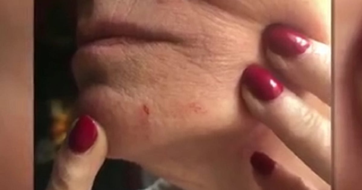Woman says she was attacked by dog in Kissimmee | FOX 35 Orlando