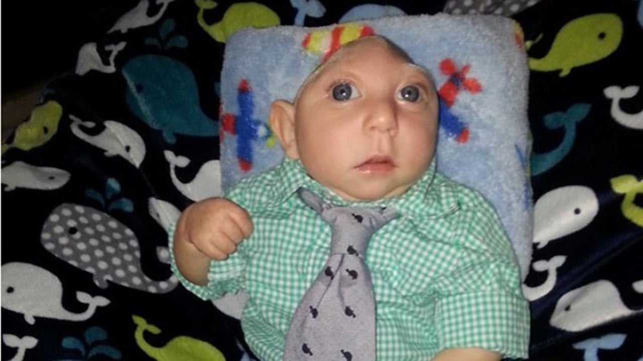 Мальчик родившийся без мозгов. Джексон Эммет Буэлл анэнцефалия 2020.
