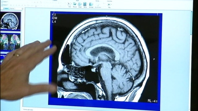 NFL: Preseason concussion rate increased by 44 percent