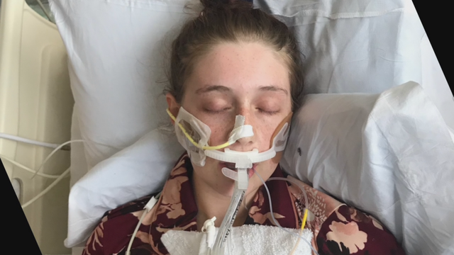 Family believes girl, 17, on life support at Dallas hospital due to vaping