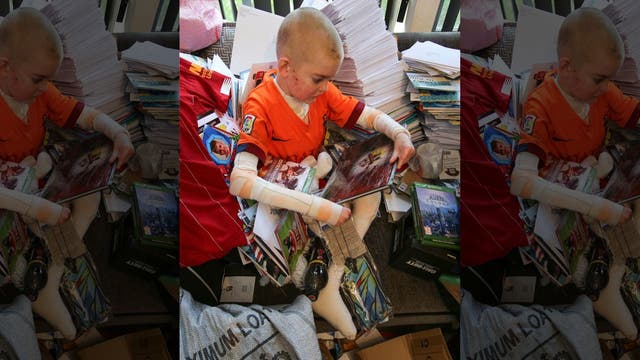 Thousands send cards to teen with rare skin disease after mom's plea goes viral