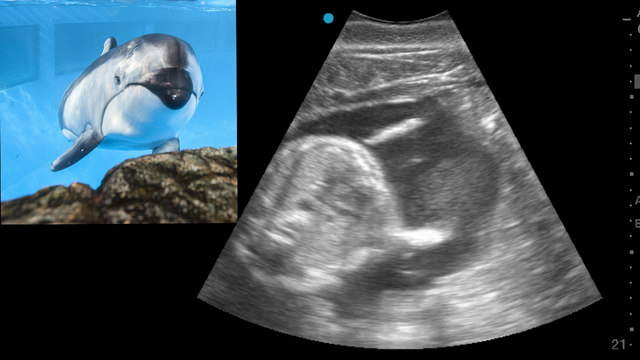Pacific white-sided dolphin at Chicago aquarium is expecting