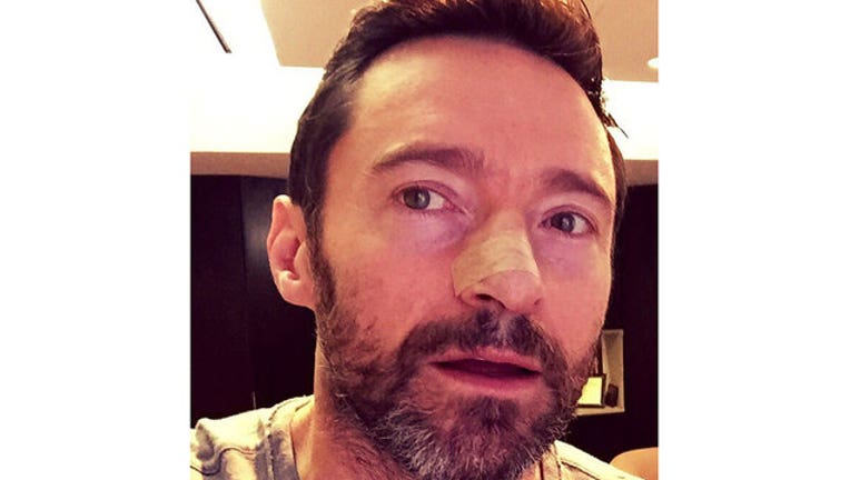 5f29f19f-Hugh Jackman-402970