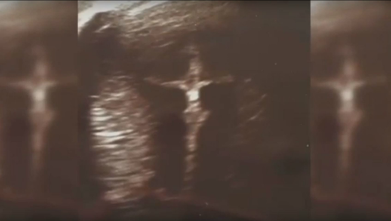 3be60825-jesus-sonogram_1461162982510-404023.png