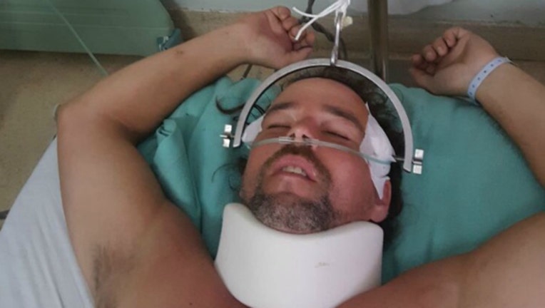 3abd0a14-man injured chasing monkey gofundme-404023