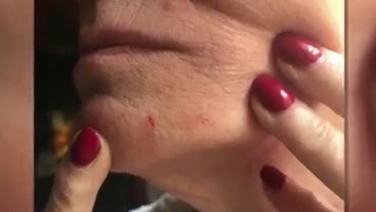 9ef5e01a-woman attacked by dog_1552874267318.jpg.jpg