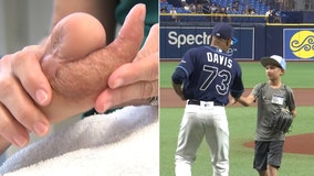 Tampa boy, a partial-hand amputee, throws first pitch at Tampa Bay Rays game