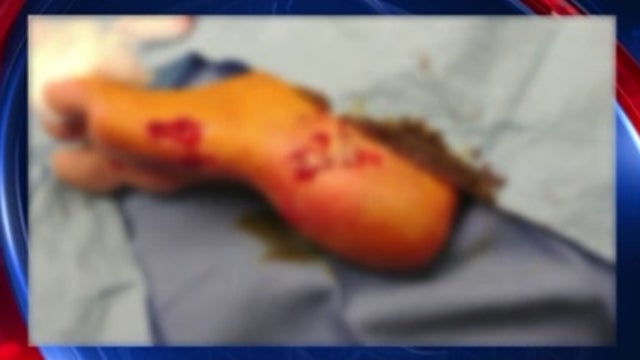 Surfer who accidentally jumped on shark speaks out