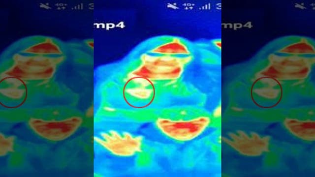 Woman diagnosed with breast cancer after museum thermal camera reveals hot spot