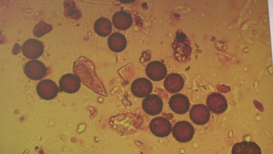 allergens-under-the-microscope.png