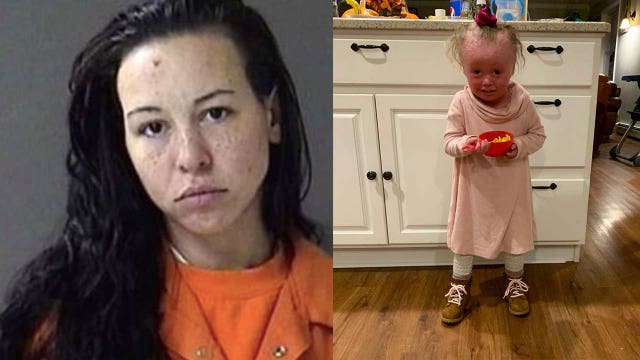 Woman arrested for allegedly harassing toddler with genetic skin disorder