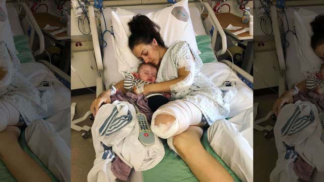 Mom 'grateful' to be alive after losing leg in horrorific motorcycle accident