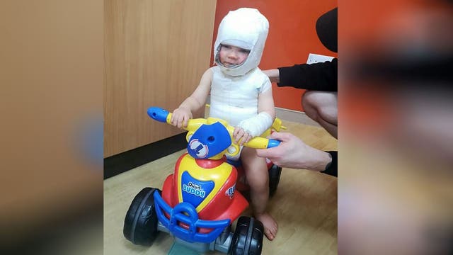 Toddler burned when vegetable steamer topples over on him