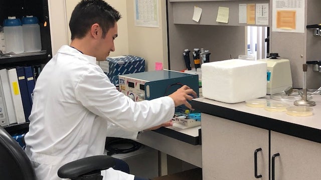 UCF researchers discover possible Alzheimer's breakthrough