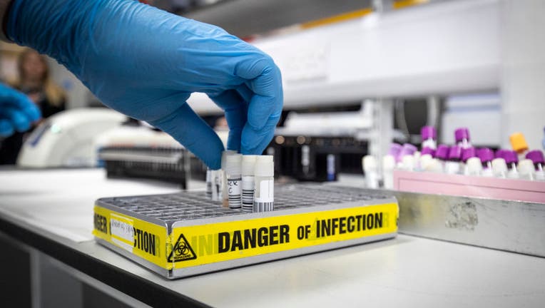 FILE - Clinical support technician Douglas Condie extracts viruses from swab samples so that the genetic structure of a virus can be analysed and identified in the coronavirus testing laboratory at Glasgow Royal Infirmary, on Feb. 19, 2020 in Glasgow, Scotland.