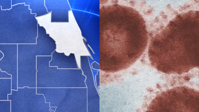 2 coronavirus testing facilities coming to Volusia County, Florida representative says