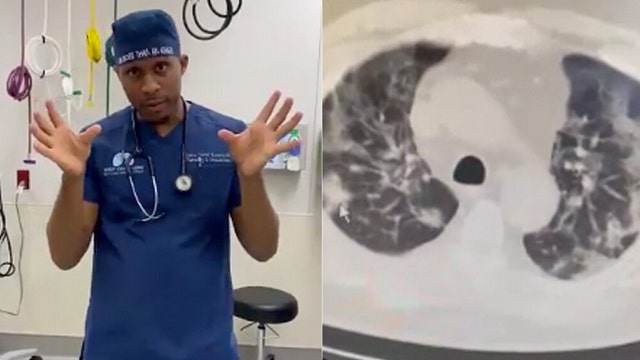 Doctor shows how COVID-19 affects the lungs of severely sick patients