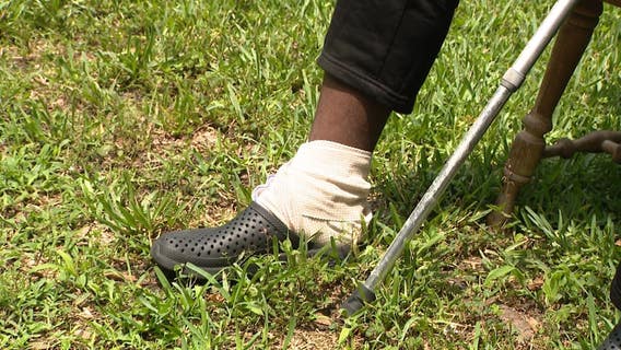 Police investigate after protester's foot was run over in Daytona Beach