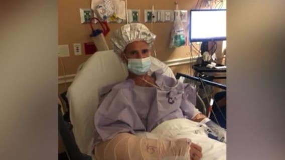 Tavares firefighter who nearly lost his arm after gator bite speaks to FOX 35