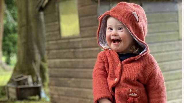 Girl, 2, with Down syndrome stars in fashion campaign