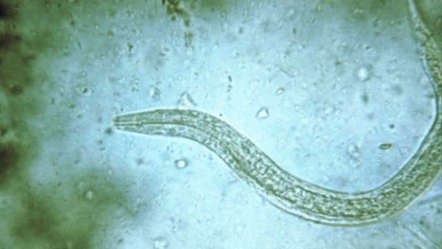 Woman’s headache caused by tapeworm larvae in brain: case report