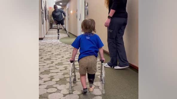 Paralympic medalist cheers on little boy taking first steps with prosthetic leg