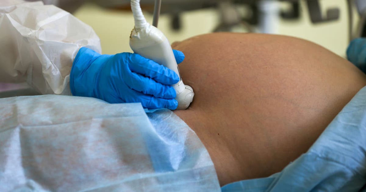 Florida House passes bill banning abortions after 15 weeks | FOX 35 Orlando