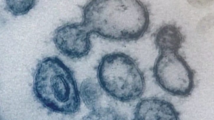 NIH study finds coronavirus infects mouth cells, saliva - Vimarsana News