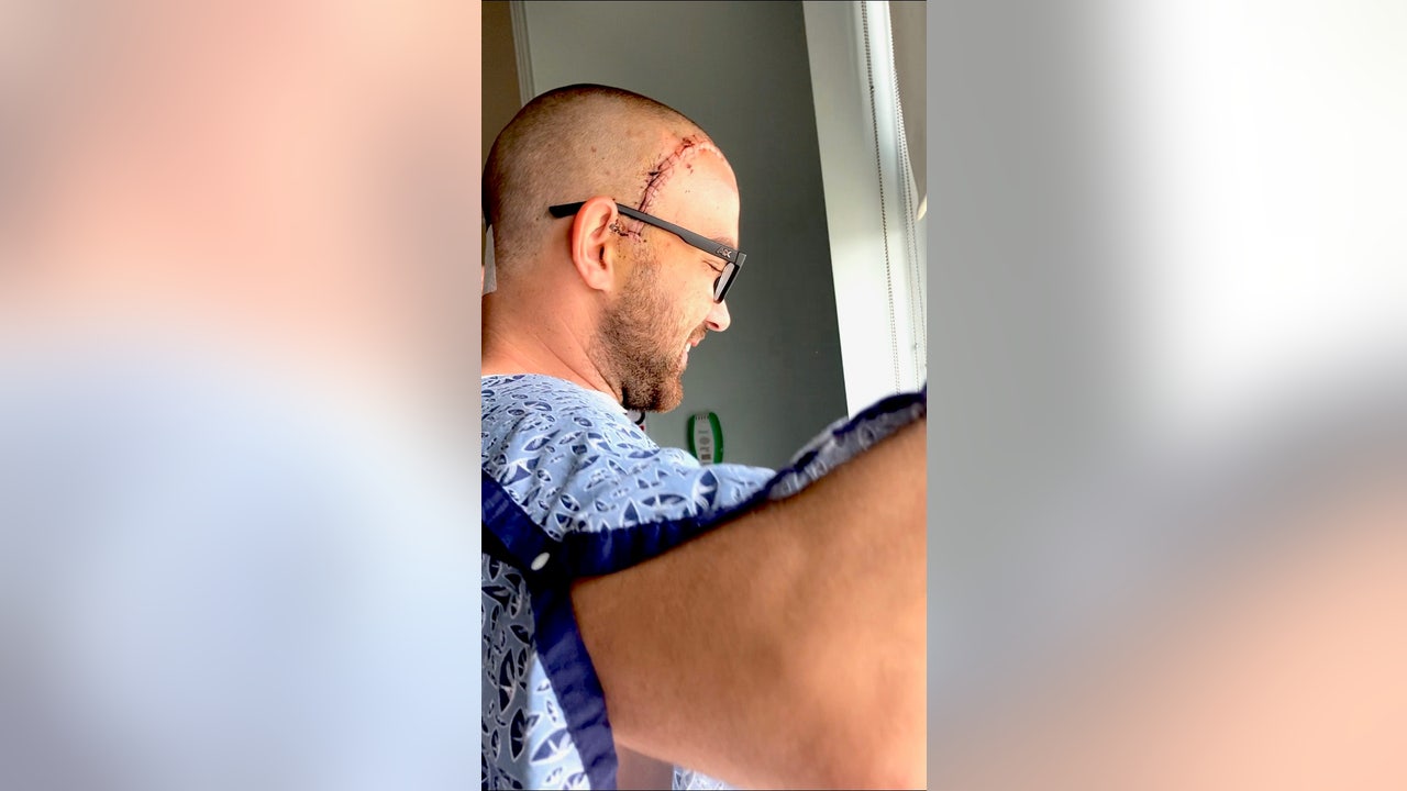 Ocoee Fire Department goes above and beyond to help firefighter with brain tumor - Vimarsana News