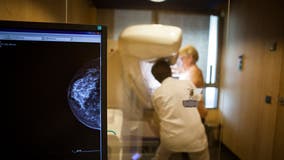 Breast cancer pill shows benefit in certain hard-to-treat cases