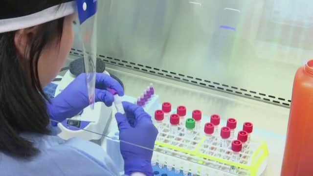COVID-19 and Alzheimer's: Researchers find worrisome links