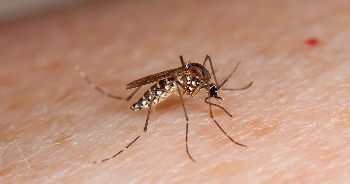 Photo: fox35orlando.com Florida Reports 41 Dengue Cases, 59 in Hillsborough County