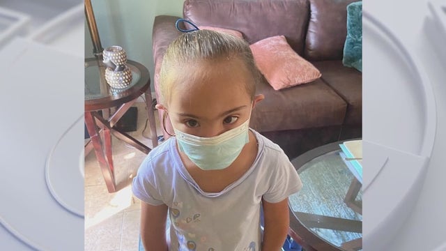 Father of child with Down syndrome says mask was tied around his daughter's head