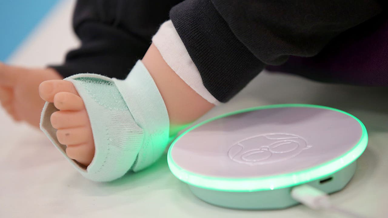 Owlet stops selling baby monitoring smart sock after FDA warning letter - Vimarsana News