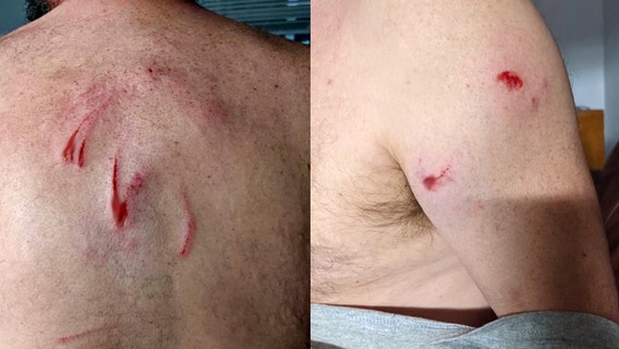 FWC responds to reported bear attack in Daytona Beach