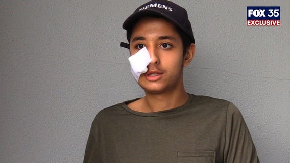 Eustis teen shot in face released from hospital, speaks to FOX 35