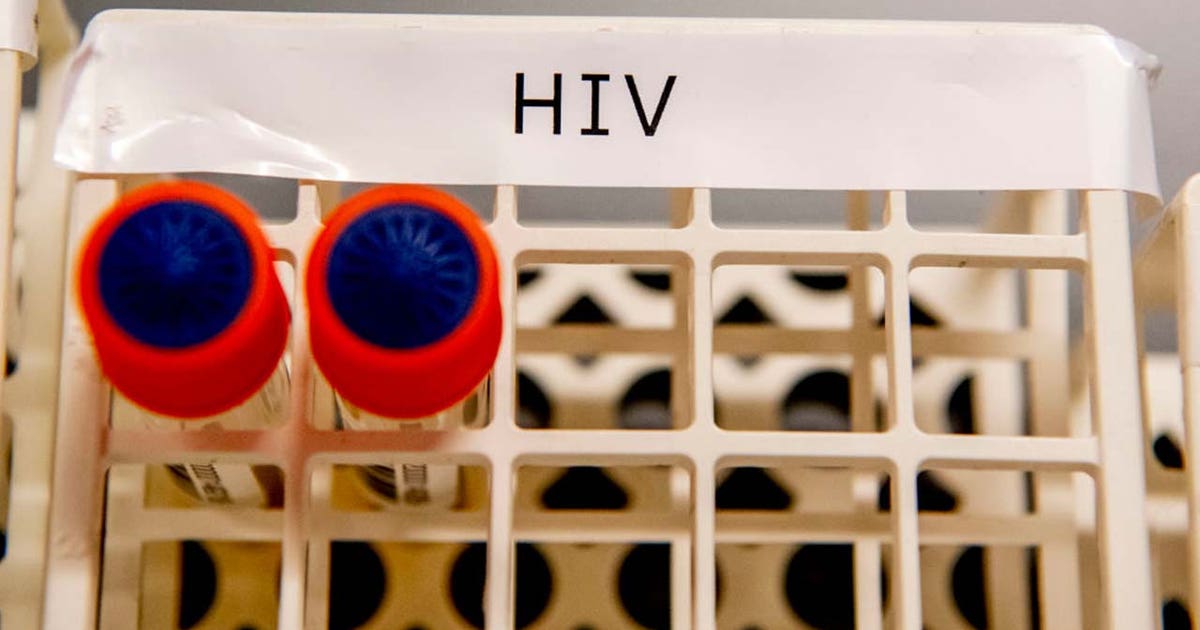 Florida moves to cull thousands from HIV drug access program