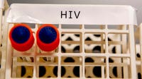 Florida moves to cull thousands from HIV drug access program