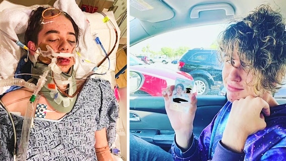 'It’s a miracle that he’s still with us': Teen out of coma nearly a month after hit-and-run