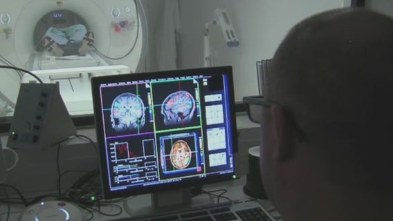 New Alzheimer's Disease clinical trial in Central Florida inching closer to a cure