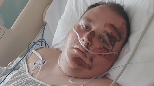 Woman says road rage driver ran over her fiancé after following her to her house