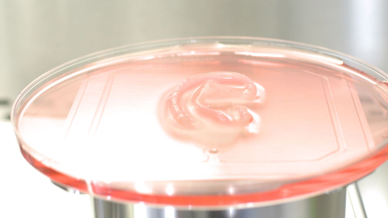 New 3D-printed ear could be a game-changer for organ transplants, doctors say - Vimarsana News