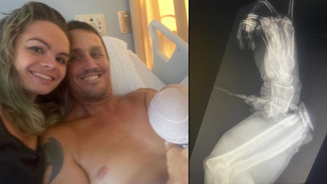 Florida alligator handler has arm partially amputated following second attack in 9 years